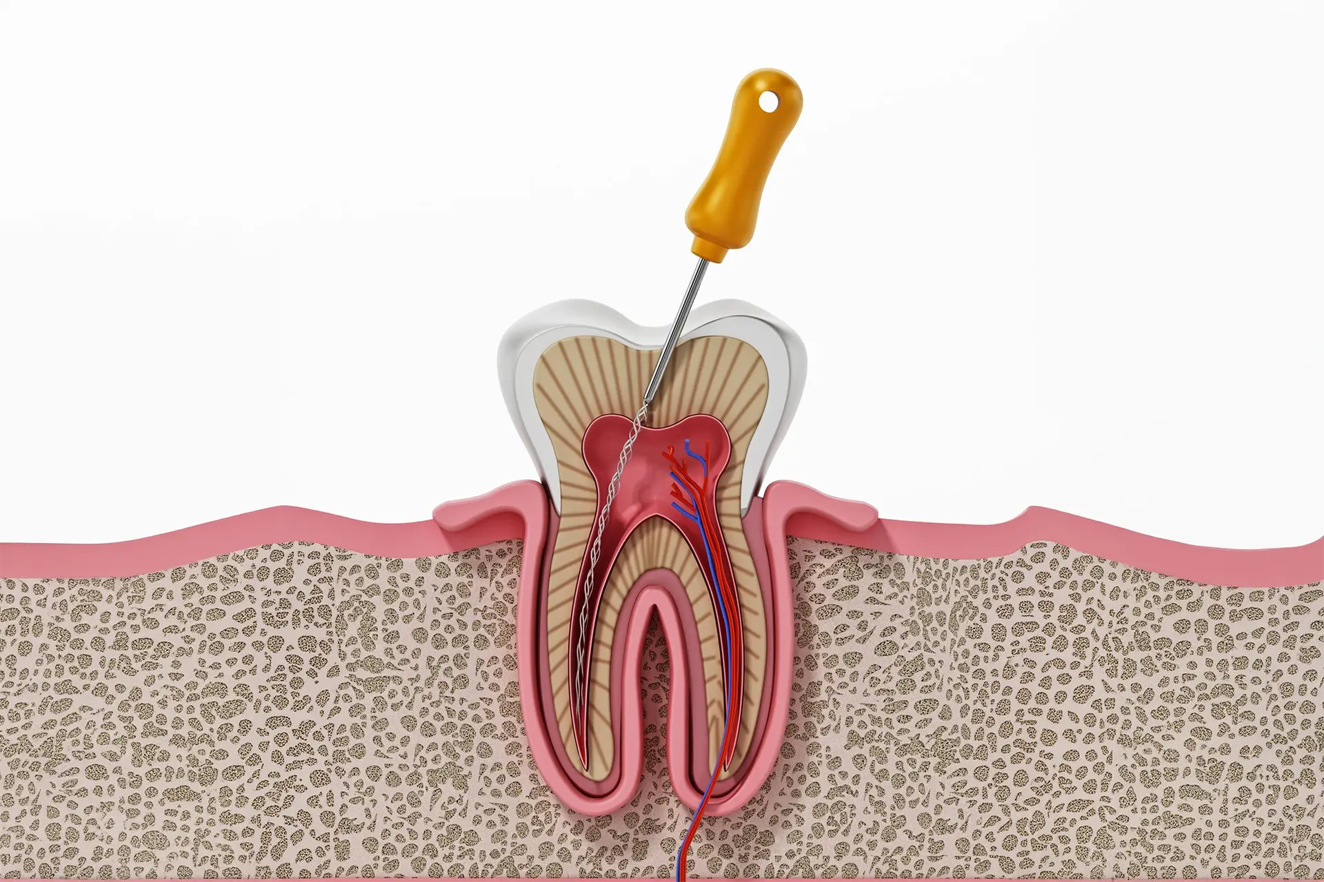 Dentist assessing patient for root canal treatment in Leicester